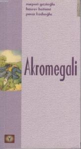 Akromegali