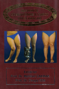 Deformite Cerrahisinde İlizarov Cerrahisi