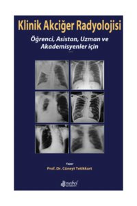 Klinik Akciğer Radyolojisi