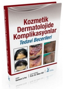 Kozmetik Dermatolojide Komplikasyonlar:Tedavi Becerileri