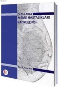 Olgularla Meme Hastalıkları Radyolojisi