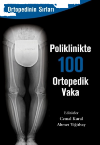 Poliklinkte 100 Ortopedik Vaka
