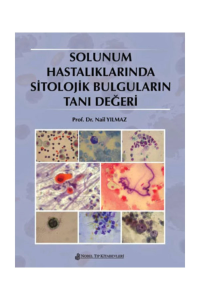 Solunum Hastalıklarında Sitolojik Bulguların Tanı Değeri