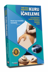 Tetik Nokta Tedavisinde Kuru İğneleme