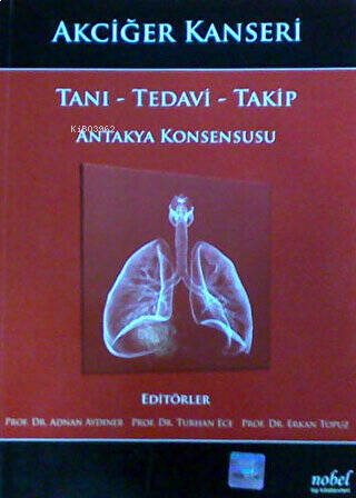 Akciğer Kanseri: Tanı - Tedavi - Takip - Antakya Konsensusu
