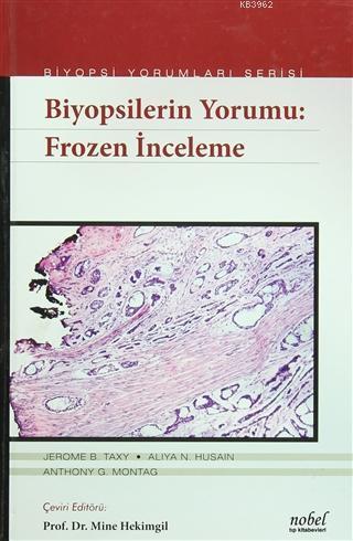 Biyopsilerin Yorumu: Frozen İnceleme