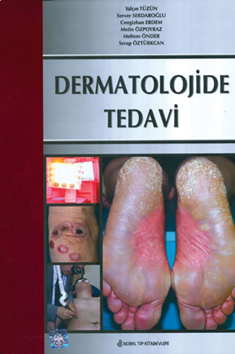 Dermatolojide Tedavi