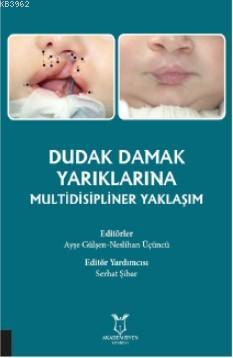 Dudak Damak Yarıklarına Multidisipliner Yaklaşım