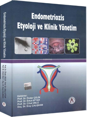 Endometriozis etyoloji ve klinik yönetim