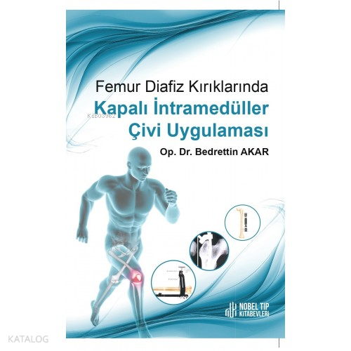 Femur Diafiz Kırıklarında Kapalı İntramedüller Çivi Uygulaması