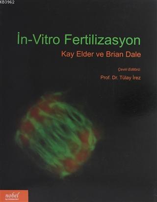 İn-Vitro Fertilizasyon