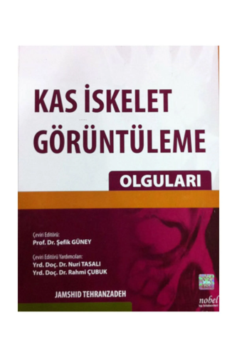 Kas İskelet Görüntüleme Olguları