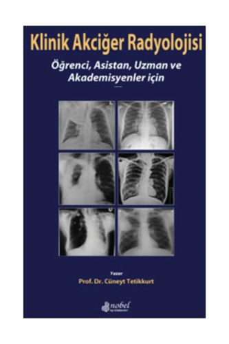 Klinik Akciğer Radyolojisi