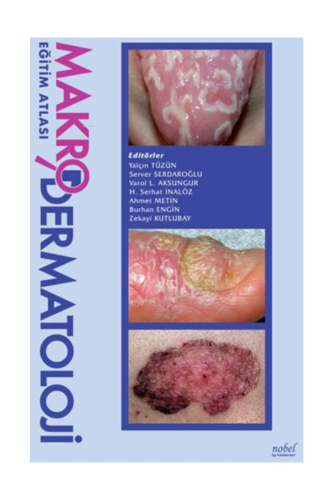 Makrodermatoloji Eğitim Atlası