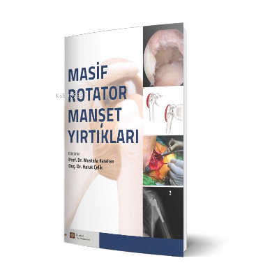 Masif Rotator Manşet Yırtıkları