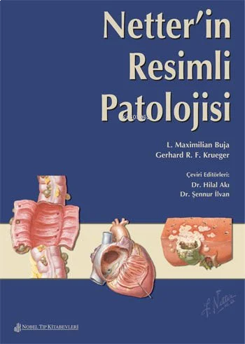 Netter'İn Resimli Patolojisi