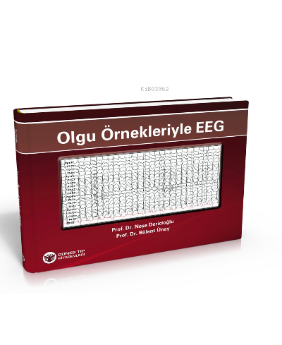 Olgu Örnekleriyle EEG