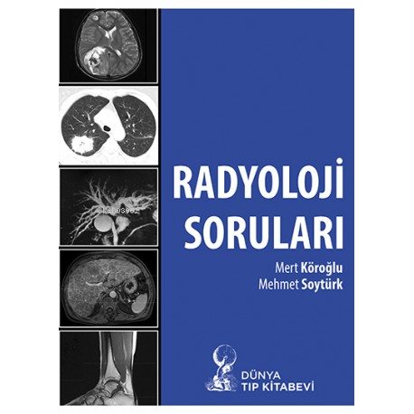 Radyoloji Soruları