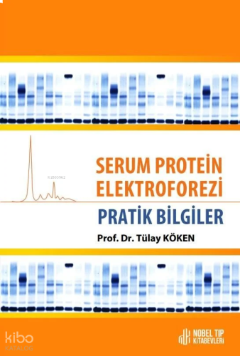 Serum Protein Elektroforezi - Pratik Bilgiler