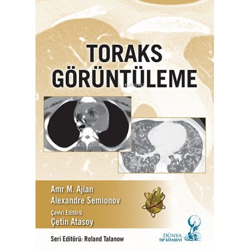Toraks Görüntüleme