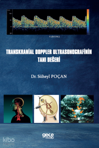 Transkranial Doppler Ultrasonografinin Tanı Değeri