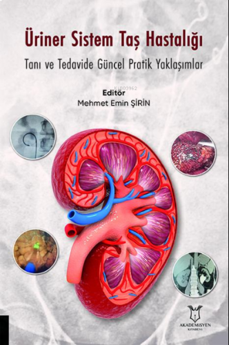 Üriner Sistem Taş Hastalığı: Tanı ve Tedavide Güncel Pratik Yaklaşımlar