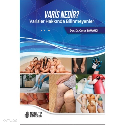 Varis Nedir? Varis Hakkında Bilinmeyenler