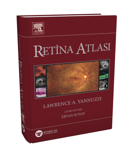 Yannuzzi Retina Atlası